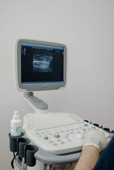 Ultrasound machine